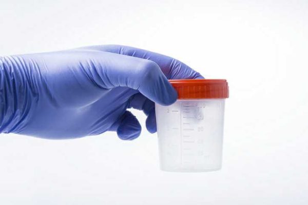 Drug Testing